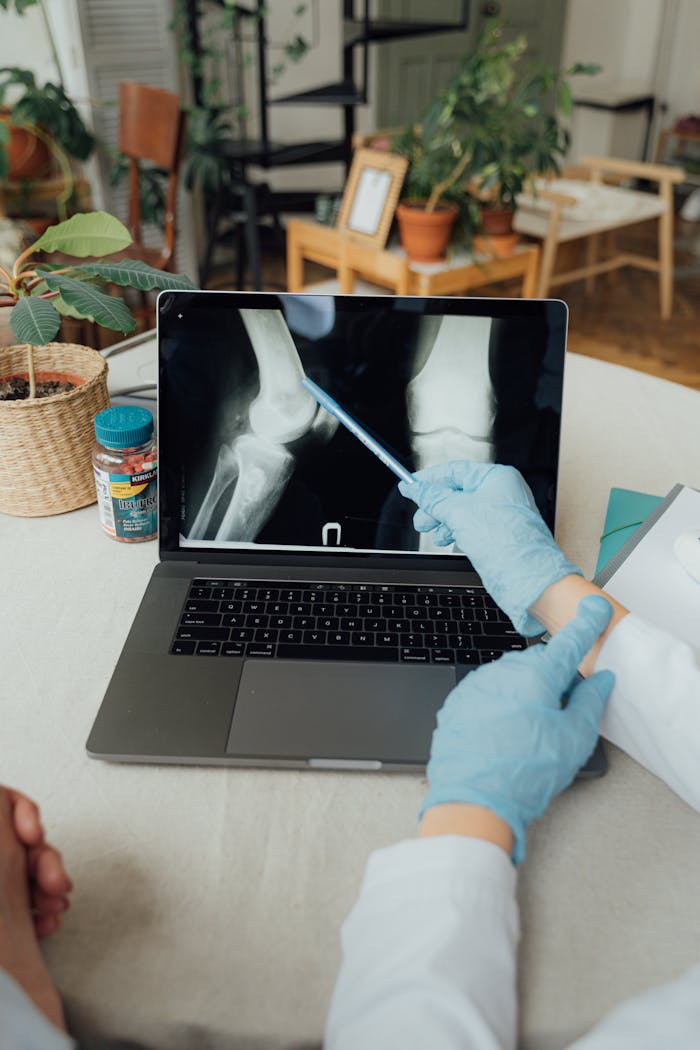 A doctor in gloves analyzing a knee X-ray on a laptop, emphasizing telemedicine and digital healthcare.